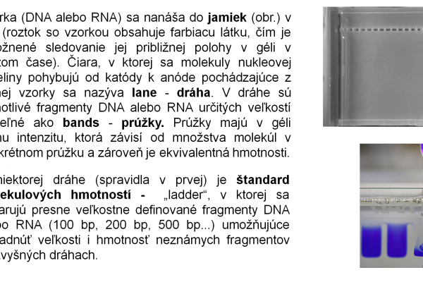 Elektroforéza v agarózovom géli – 3