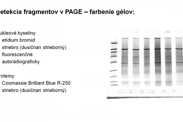 Elektroforéza v PAGE – 8